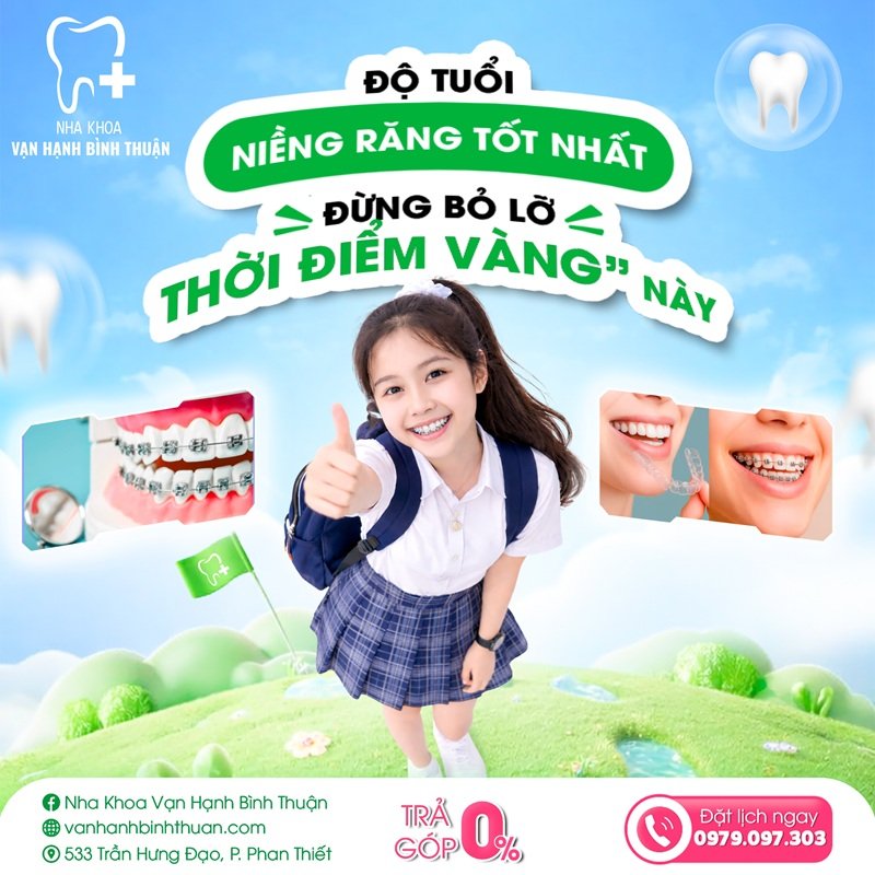 Độ tuổi niềng răng tốt nhất: Đừng bỏ lỡ thời điểm vàng này